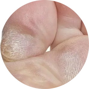 Ursache Icon